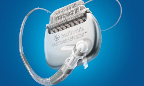 Medtronic Ankerstim™ Occipital Nerve Stimulation Device