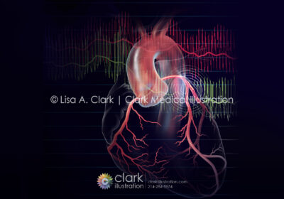 FFR and iFR Illustration