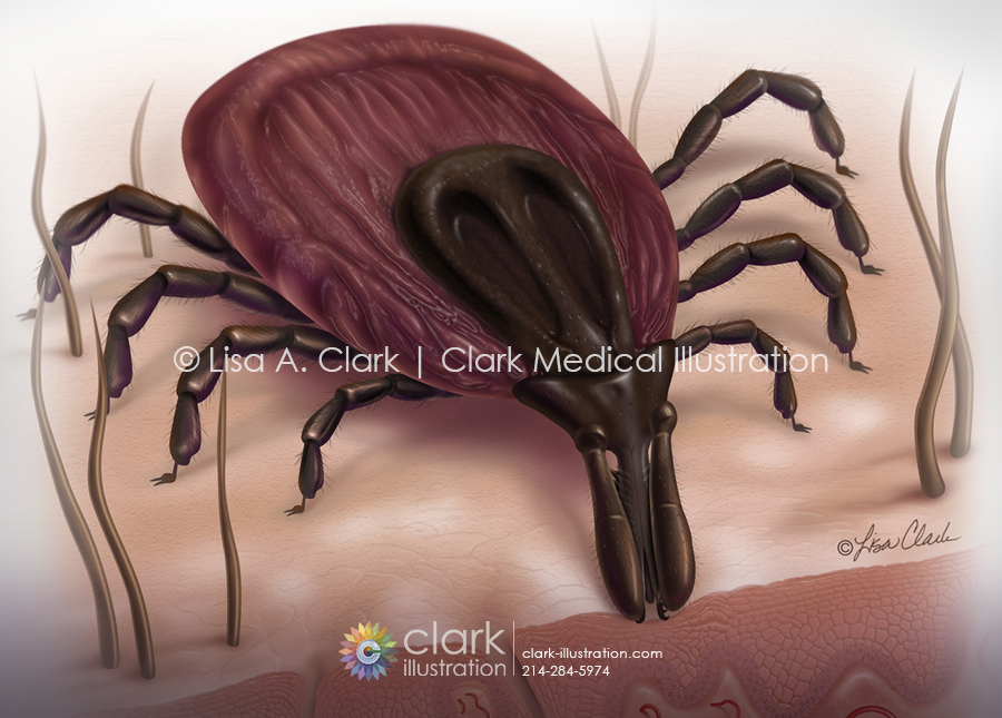 Tick medical illustration