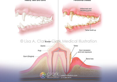 Canine Periodontal Disease